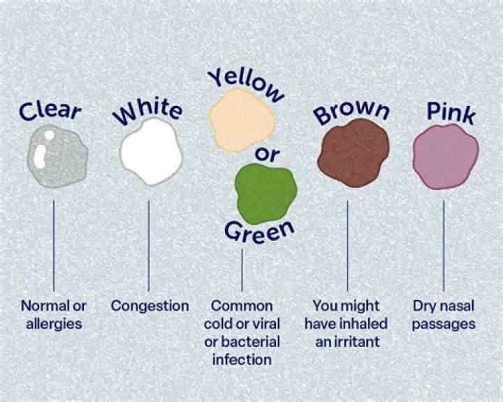 Why is my snot like rubber cement?