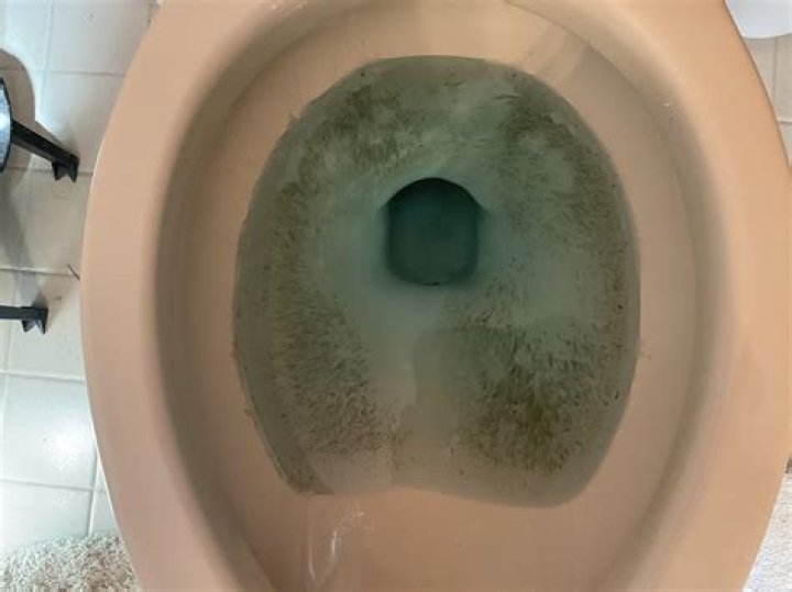 Why is my toilet bowl green?