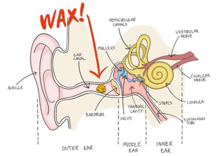 Why is there earwax on my pillow?