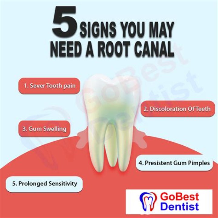 Why you should not get root canal?