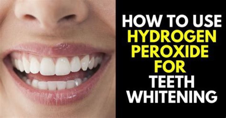 Will hydrogen peroxide whiten crowns?
