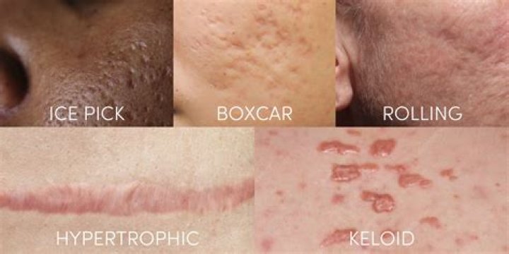 Will my pink scars ever fade?