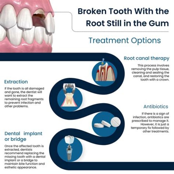 Will the root of a broken tooth eventually fall out?