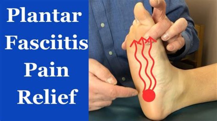 Will Voltaren help plantar fasciitis?